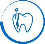 Dental Root Canal Treatment